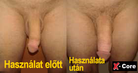 igazi pénisz kárt a péniszben